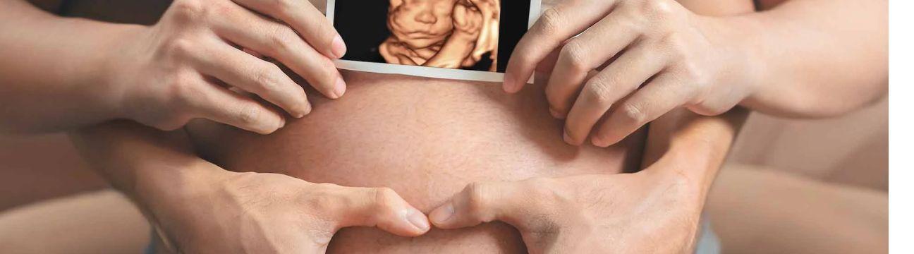 Tummy Vision 3D/4D  Ultrasound & Gender Reveal